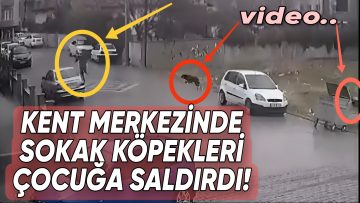 KIRŞEHİR’DE SOKAK KÖPEKLERİ ÇOCUĞA SALDIRDI